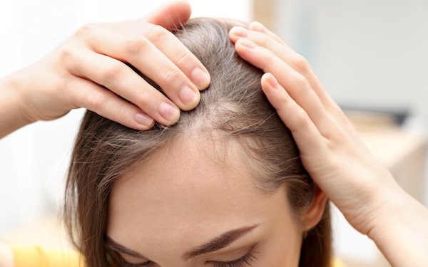 Why Your Hair Is Thinning and How to Restore Hair Growth Naturally