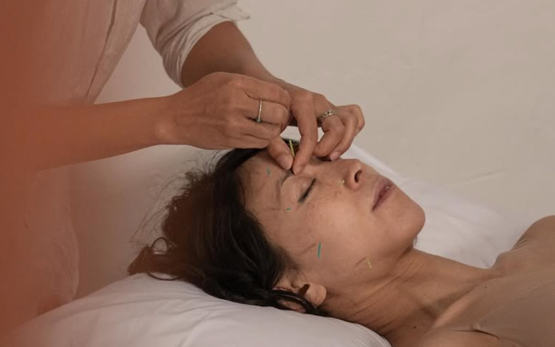 Glow Naturally with Lume’s Acupuncture Facial - now available four days a week Image